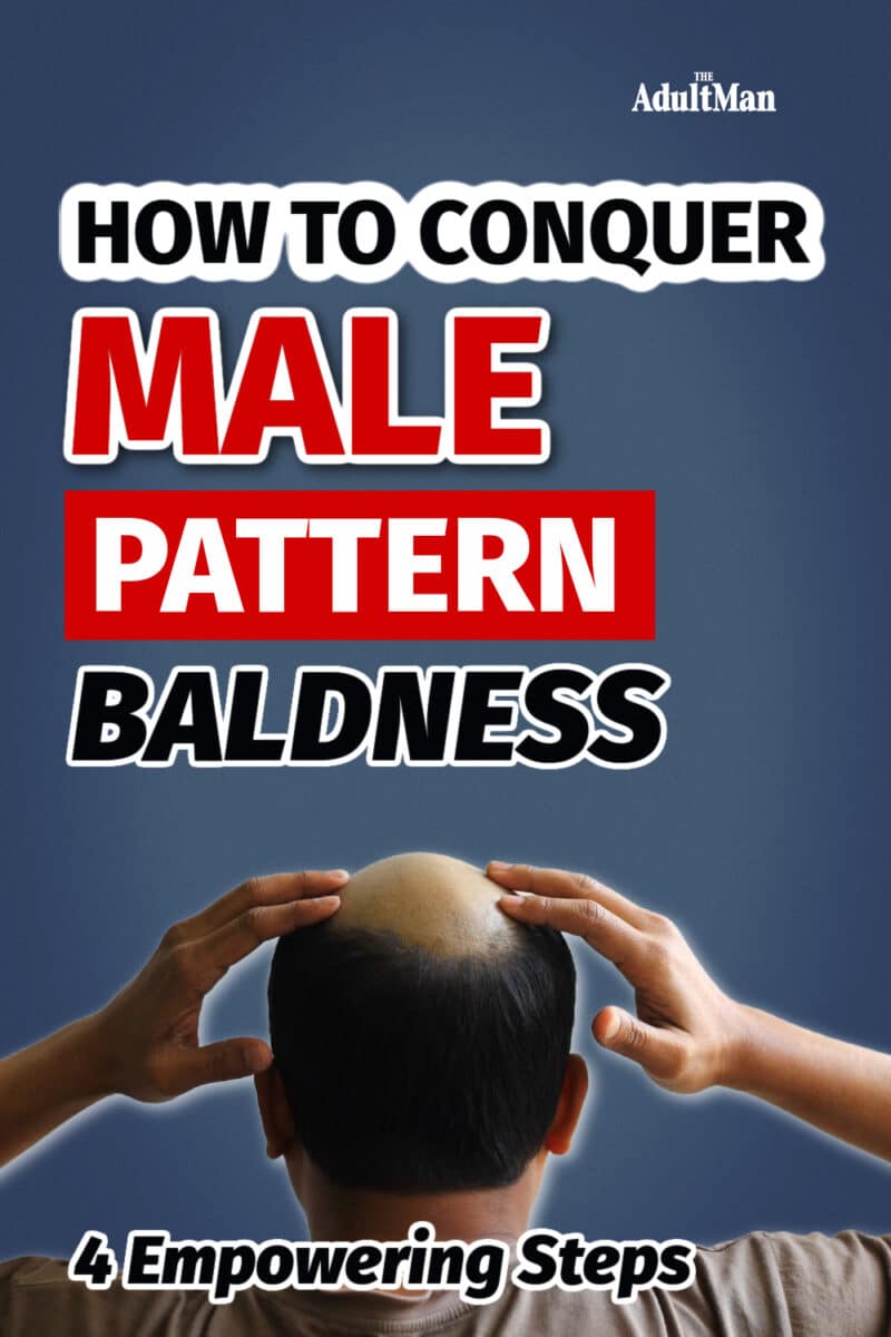 How To Conquer Male Pattern Baldness: 4 Empowering Steps